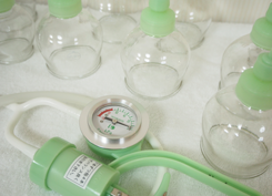 吸角療法・カッピング