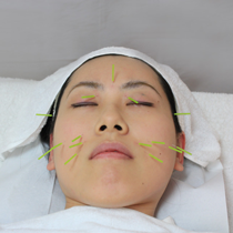 美容鍼・美顔マッサージ